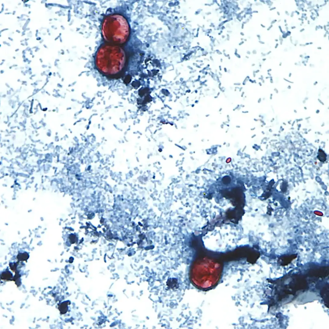 As cyclospora illnesses surge to a record, Michigan officials eye lettuce as a possible cause